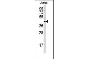 Western blot analysis of anti-PTPN7 Antibody in Jurkat cell line lysates (35ug/lane). (PTPN7 抗体  (Ser44))