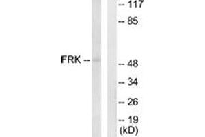 Western blot analysis of extracts from Jurkat cells, using FRK Antibody. (FRK 抗体  (AA 71-120))