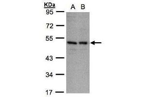 WB Image Sample(30 ug whole cell lysate) A:A431, B:H1299 10% SDS PAGE antibody diluted at 1:1000 (KIR3DL1 抗体  (Center))