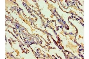 Immunohistochemistry of paraffin-embedded human lung tissue using ABIN7160405 at dilution of 1:100 (MYEF2 抗体  (AA 372-576))