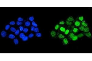 IF analysis of HOXD11 using anti-HOXD11 antibody (ABIN7603174). (HOXD11 抗体  (N-Term))