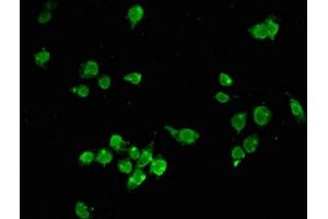 Immunofluorescent analysis of SH-SY5Y cells using ABIN7155209 at dilution of 1:100 and Alexa Fluor 488-congugated AffiniPure Goat Anti-Rabbit IgG(H+L) (HMGB2 抗体  (AA 43-185))