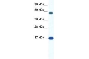 WB Suggested Anti-ZNF554 Antibody Titration:  0. (ZNF554 抗体  (N-Term))