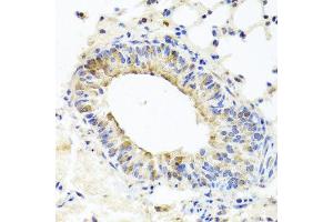 Immunohistochemistry of paraffin-embedded mouse lung using MUC16 antibody at dilution of 1:100 (x40 lens). (MUC16 抗体)