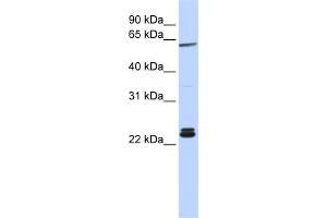 WB Suggested Anti-H1F0 Antibody Titration: 0. (Histone H1 抗体  (N-Term))