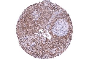 Lymph node with a strong nuclear p27 staining of most interfollicular lymphocytes while most germinal centre cells remain p27 negative