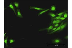 Immunofluorescence of purified MaxPab antibody to PLA2G16 on HeLa cell. (PLA2G16 抗体  (AA 1-162))