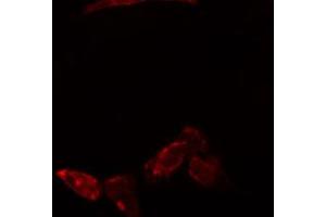 ABIN6274773 staining Hela cells by IF/ICC. (RPL23 抗体  (C-Term))
