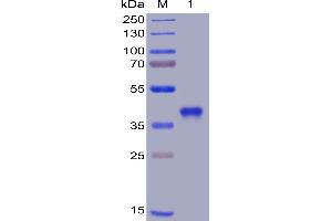 SARS-CoV-2 (2019-nCoV) S protein RBD, His Tag on SDS-PAGE under reducing condition.