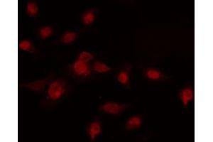 ABIN6274228 staining COLO205 cells by IF/ICC. (HOXA7 抗体  (Internal Region))