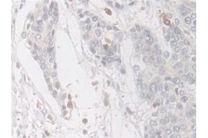 Immunohistochemistry (IHC) image for anti-Coactosin-Like Protein (AA 1-142) antibody (ABIN7436669)