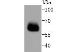 Lane 1: PC-12 lysates probed with Smad4 (3A1) Monoclonal Antibody  at 1:1000 overnight at 4˚C. (SMAD4 抗体)