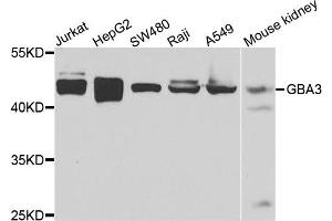 Western blot analysis of extracts of various cells, using GBA3 antibody. (GBA3 抗体)