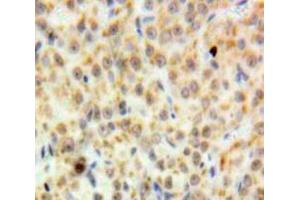 #VALUE! (DDB2 抗体  (AA 166-383))