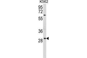 Western blot analysis of UPK1B Antibody (Center) in K562 cell line lysates (35 µg/lane). (Uroplakin 1B 抗体  (Middle Region))