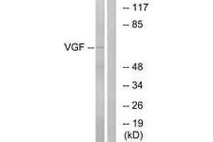 Western blot analysis of extracts from RAW264. (VGF 抗体  (AA 454-503))