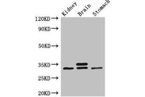Western Blot Positive WB detected in: Mouse kidney tissue, Mouse brain tissue, Mouse stomach tissue All lanes: SCGN antibody at 3 μg/mL Secondary Goat polyclonal to rabbit IgG at 1/50000 dilution Predicted band size: 33 kDa Observed band size: 33 kDa (SCGN 抗体  (AA 1-276))