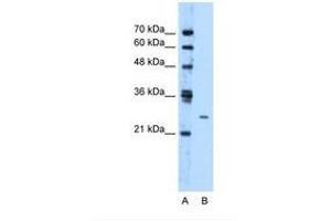 Image no. 1 for anti-Transmembrane Protein 126B (TMEM126B) (AA 141-190) antibody (ABIN321580) (TMEM126B 抗体  (AA 141-190))