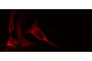 ABIN6274660 staining Hela cells by IF/ICC. (CYP4X1 抗体)
