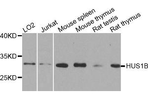 Western blot analysis of extracts of various cell lines, using HUS1B antibody. (HUS1B 抗体)