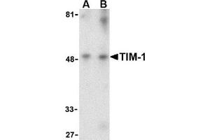 Western blot analysis of TIM-1 in human uterus tissue lysate with this product at (A) 1 and (B) 2 μg/ml. (HAVCR1 抗体  (Center))