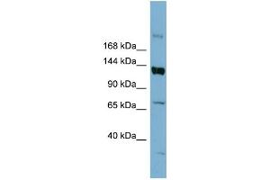 WB Suggested Anti-ABCB4 Antibody Titration:  0. (ABCB4 抗体  (Middle Region))