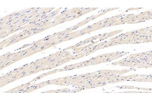 Detection of CRHBP in Rat Cardiac Muscle Tissue using Monoclonal Antibody to Corticotropin Releasing Hormone Binding Protein (CRHBP) (CRHBP 抗体  (AA 25-322))