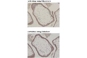 Immunohistochemistry (IHC) image for anti-CD274 (PD-L1) (Extracellular Domain) antibody (ABIN1449244) (PD-L1 抗体  (Extracellular Domain))