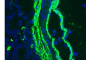 Image no. 3 for anti-Actin, alpha 2, Smooth Muscle, Aorta (ACTA2) antibody (ABIN335372) (Smooth Muscle Actin 抗体)