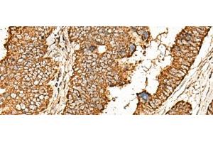 Immunohistochemistry (Paraffin-embedded Sections) (IHC (p)) image for anti-ATP Synthase, H+ Transporting, Mitochondrial F0 Complex, Subunit E (ATP5I) antibody (ABIN7245119)