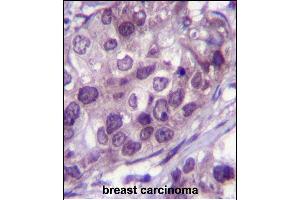 Immunohistochemistry (Paraffin-embedded Sections) (IHC (p)) image for anti-Nuclear Receptor Subfamily 3, Group C, Member 1 (Glucocorticoid Receptor) (NR3C1) (AA 236-262) antibody (ABIN651659)