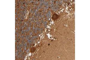 Immunohistochemical staining (Formalin-fixed paraffin-embedded sections) of human cerebellum with IQCJ-SCHIP1 polyclonal antibody  shows strong cytoplasmic positivity in Purkinje cells at 1:20-1:50 dilution. (IQCJ-SCHIP1 Readthrough (IQCJ-SCHIP1) 抗体)