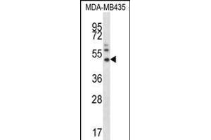 P16 Antibody  (ABIN390140 and ABIN2840644) western blot analysis in MDA-M cell line lysates (35 μg/lane). (MMP16 抗体  (N-Term))