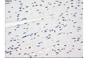 Image no. 5 for anti-Fc gamma RII (CD32) antibody (ABIN1497256) (Fc gamma RII (CD32) 抗体)