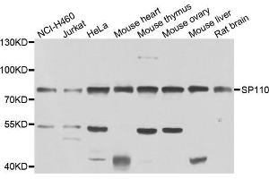 Western blot analysis of extracts of various cell lines, using SP110 antibody (ABIN5975571) at 1/1000 dilution. (SP110 抗体)