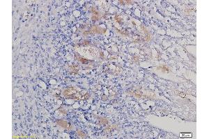 Formalin-fixed and paraffin embedded rat intestine labeled with Anti-SHC Polyclonal Antibody, Unconjugated (ABIN700990) at 1:200 followed by conjugation to the secondary antibody and DAB staining.