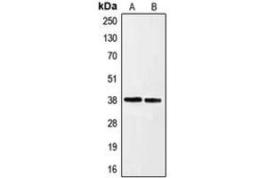 Western blot analysis of Ephrin A3 expression in HeLa (A), HepG2 (B) whole cell lysates. (Ephrin A3 抗体  (C-Term))