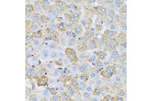 Immunohistochemistry of paraffin-embedded rat liver using APOC1 antibody (ABIN5973281) at dilution of 1/100 (40x lens). (APOC1 抗体)