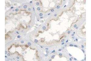 DAB staining on IHC-P; Samples: Human Kidney Tissue (TBXA2R 抗体  (AA 3-324))