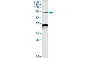Immunoprecipitation of MKKS transfected lysate using anti-MKKS MaxPab rabbit polyclonal antibody and Protein A Magnetic Bead , and immunoblotted with MKKS purified MaxPab mouse polyclonal antibody (B01P) . (MKKS 抗体  (AA 1-570))