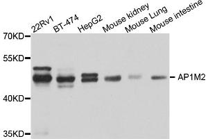 Western blot analysis of extracts of various cell lines, using AP1M2 antibody. (AP1m2 抗体)