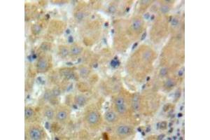 #VALUE! (Factor XI 抗体  (AA 170-398))