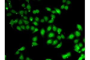 Immunofluorescence analysis of U2OS cells using AFF1 antibody. (AF4 抗体)
