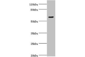Western blot All lanes: TATA box-binding protein-associated factor RNA polymerase I subunit B antibody at 4 μg/mL + Hela whole cell lysate Secondary Goat polyclonal to rabbit IgG at 1/10000 dilution Predicted band size: 69, 61, 40 kDa Observed band size: 69 kDa (TAF1B 抗体  (AA 369-588))