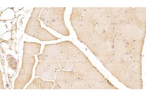 Detection of DUSP3 in Human Skeletal muscle Tissue using Monoclonal Antibody to Dual Specificity Phosphatase 3 (DUSP3) (Dual Specificity Phosphatase 3 (DUSP3) (AA 2-185) 抗体)
