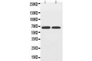 Anti-GLUT12 antibody, Western blotting Lane 1: PC-12 Cell Lysate Lane 2: A549 Cell Lysate (GLUT12 抗体  (Middle Region))