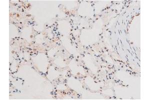 Immunohistochemistry (IHC) image for anti-Forkhead Box O4 (FOXO4) (pThr451) antibody (ABIN6256565)