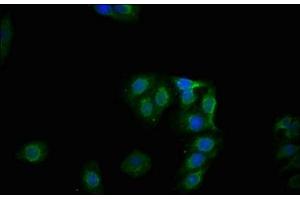 Immunofluorescence staining of HepG2 cells with ABIN7127698 at 1:100,counter-stained with DAPI. (Recombinant Glycogen Synthase 1 抗体  (pSer641))