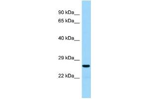 Host:  Rabbit  Target Name:  Akt1s1  Sample Type:  Rat Thymus lysates  Antibody Dilution:  1. (PRAS40 抗体  (Middle Region))