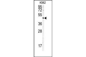 Image no. 1 for anti-Doublecortin (DCX) antibody (ABIN357927) (Doublecortin 抗体)